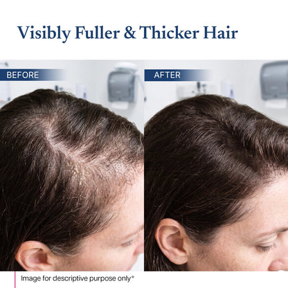 Rosemary rice water hair spray product image 6